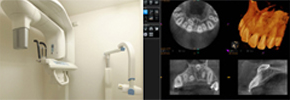 3D（立体）CT検査サービスのご案内